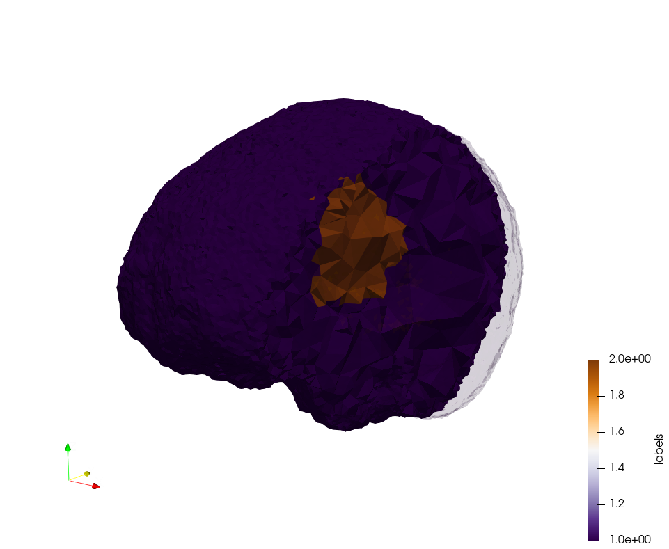 Brain-With-Tumor-Case17,d=1.5,grading.png