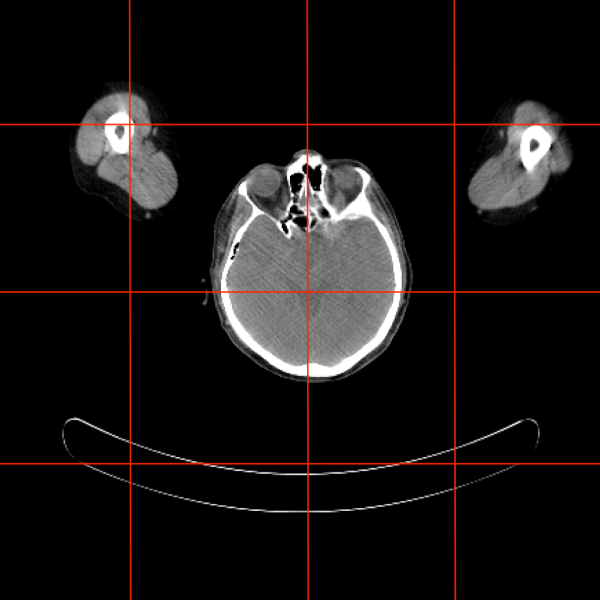File:NaF-PROSTATE-01-0001 22.png