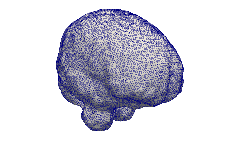File:Brain CBC3D.png
