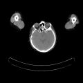 Thumbnail for version as of 16:24, 4 September 2022