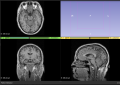 Thumbnail for version as of 11:59, 16 September 2022